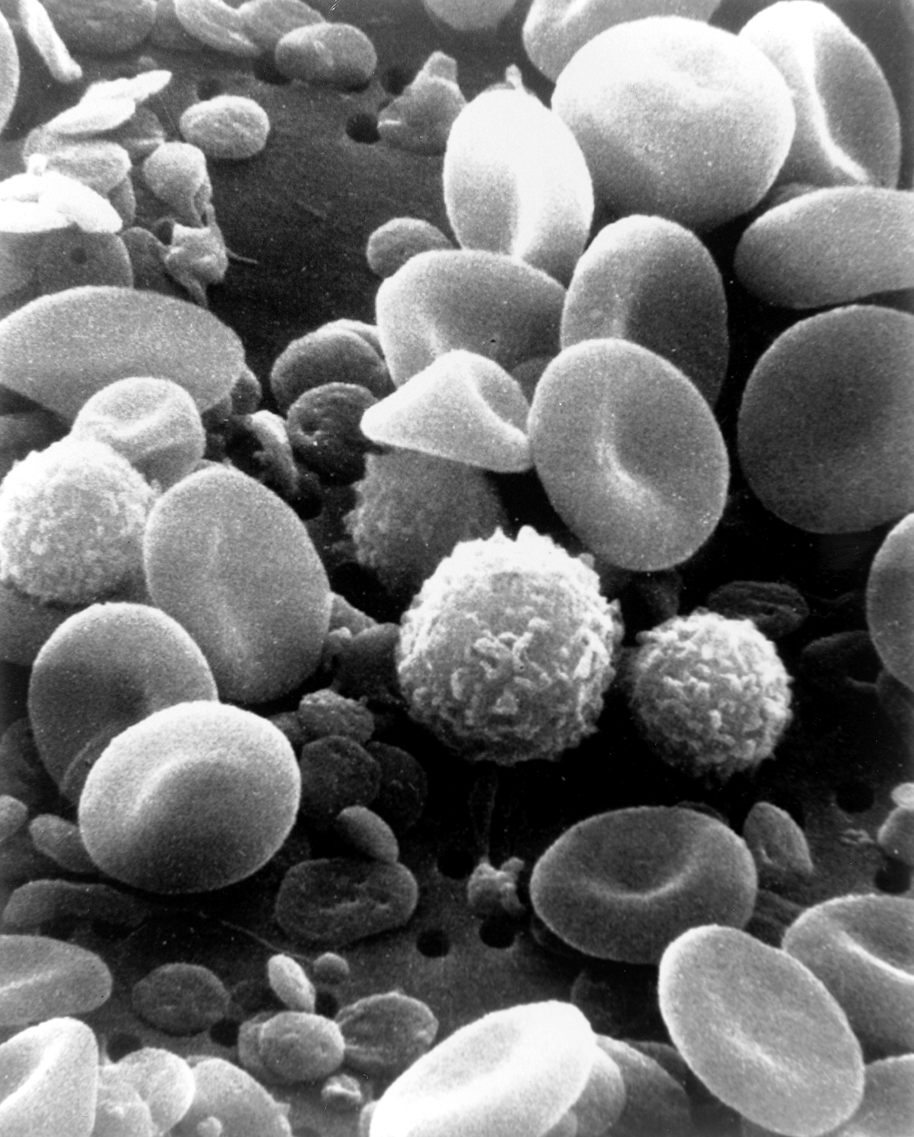 Células sanguíneas. Fuente: Wikimedia