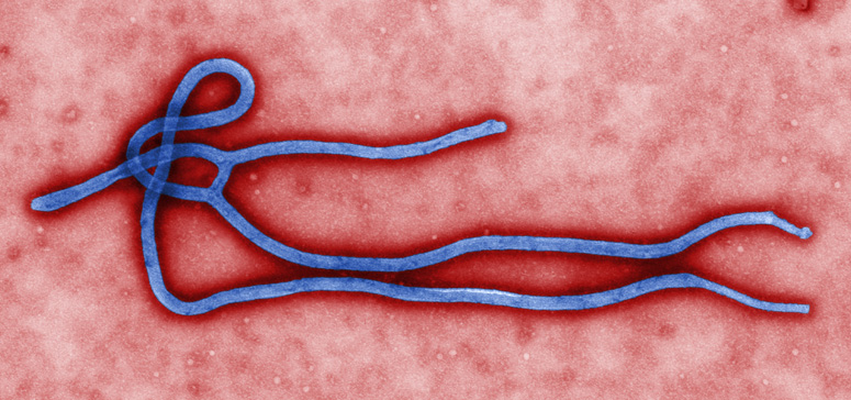 Ébola virus-Fuente Wikimedia